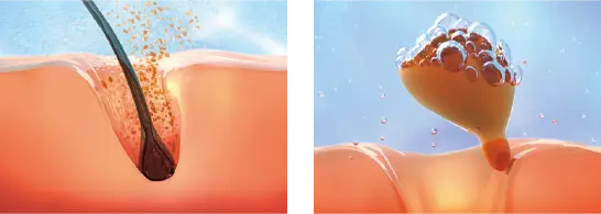 毛穴の奥まで入り込むイメージ